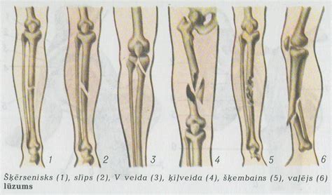 neslimo lvt.